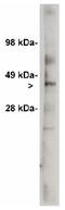 UDP Glycosyltransferase 8 antibody, AP05205PU-N, Origene, Western Blot image 