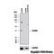C-X-C Motif Chemokine Receptor 4 antibody, NB100-56437, Novus Biologicals, Western Blot image 