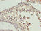 Cytochrome B5 Reductase 2 antibody, LS-C399223, Lifespan Biosciences, Immunohistochemistry paraffin image 