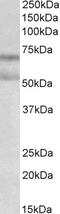 Cannabinoid Receptor 1 antibody, EB10960, Everest Biotech, Western Blot image 