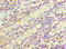 ADP Ribosylation Factor Like GTPase 4D antibody, A57149-100, Epigentek, Immunohistochemistry paraffin image 