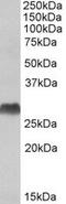 HLA class II histocompatibility antigen, DQ alpha 2 chain antibody, LS-C139656, Lifespan Biosciences, Western Blot image 