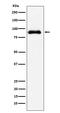 SATB Homeobox 2 antibody, M02588-2, Boster Biological Technology, Western Blot image 
