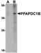 Phospholipid Phosphatase 5 antibody, orb75321, Biorbyt, Western Blot image 