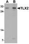 T Cell Leukemia Homeobox 2 antibody, A11164, Boster Biological Technology, Western Blot image 