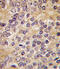 Urokinase antibody, 63-440, ProSci, Immunohistochemistry paraffin image 