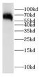 Interferon-induced, double-stranded RNA-activated protein kinase antibody, FNab02691, FineTest, Western Blot image 