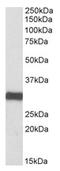 Electron transfer flavoprotein subunit alpha, mitochondrial antibody, AP21285PU-N, Origene, Western Blot image 