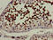 CYP51A1 antibody, LS-C677632, Lifespan Biosciences, Immunohistochemistry paraffin image 