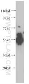 ATPase H+ Transporting V1 Subunit B1 antibody, 14780-1-AP, Proteintech Group, Western Blot image 