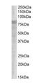 Sorting nexin-18 antibody, orb18437, Biorbyt, Western Blot image 