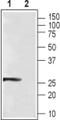 Calcium-binding protein 4 antibody, PA5-77382, Invitrogen Antibodies, Western Blot image 