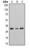 Enoyl-CoA Delta Isomerase 1 antibody, orb318845, Biorbyt, Western Blot image 