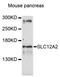 Solute carrier family 12 member 2 antibody, LS-C747069, Lifespan Biosciences, Western Blot image 