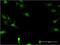 Deoxycytidine kinase antibody, MA5-18705, Invitrogen Antibodies, Immunofluorescence image 