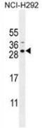 Sperm Acrosome Associated 5B antibody, AP53997PU-N, Origene, Western Blot image 