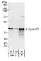 Cyclin T1 antibody, A303-498A, Bethyl Labs, Western Blot image 