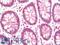 Adherens Junctions Associated Protein 1 antibody, LS-B12219, Lifespan Biosciences, Immunohistochemistry paraffin image 