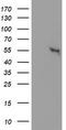 Cytosolic beta-glucosidase antibody, LS-C172737, Lifespan Biosciences, Western Blot image 