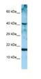 Artemin antibody, NBP1-98555, Novus Biologicals, Western Blot image 