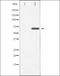 ATP Binding Cassette Subfamily G Member 2 (Junior Blood Group) antibody, orb227828, Biorbyt, Western Blot image 