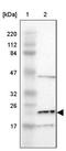 Retrotransposon Gag Like 6 antibody, PA5-52186, Invitrogen Antibodies, Western Blot image 