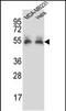 Prolylcarboxypeptidase antibody, PA5-48567, Invitrogen Antibodies, Western Blot image 