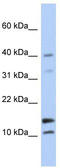 WAP Four-Disulfide Core Domain 5 antibody, TA340411, Origene, Western Blot image 