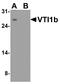 Vesicle Transport Through Interaction With T-SNAREs 1B antibody, A07432, Boster Biological Technology, Western Blot image 