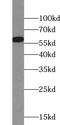 Zinc Finger And BTB Domain Containing 37 antibody, FNab09592, FineTest, Western Blot image 