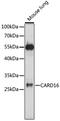 Caspase Recruitment Domain Family Member 16 antibody, 16-685, ProSci, Western Blot image 