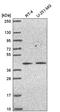 Dual specificity protein phosphatase 1 antibody, HPA069577, Atlas Antibodies, Western Blot image 