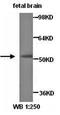 Septin-4 antibody, orb76953, Biorbyt, Western Blot image 
