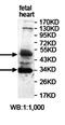 Phosphatidylinositol-5-phosphate 4-kinase type-2 beta antibody, orb78130, Biorbyt, Western Blot image 