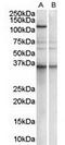 Pumilio homolog 2 antibody, TA303005, Origene, Western Blot image 