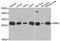 Guanidinoacetate N-Methyltransferase antibody, A02886, Boster Biological Technology, Western Blot image 