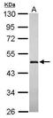 Group XV phospholipase A2 antibody, PA5-31700, Invitrogen Antibodies, Western Blot image 