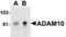 ADAM Metallopeptidase Domain 10 antibody, AHP586, Bio-Rad (formerly AbD Serotec) , Western Blot image 