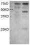 Dyslexia susceptibility 1 candidate gene 1 protein antibody, TA302996, Origene, Western Blot image 