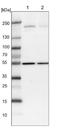 Synaptojanin-2 antibody, NBP1-87843, Novus Biologicals, Western Blot image 