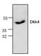Dickkopf WNT Signaling Pathway Inhibitor 4 antibody, TA318998, Origene, Western Blot image 