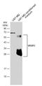 Vascular Endothelial Growth Factor C antibody, GTX113574, GeneTex, Western Blot image 