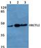 Solute Carrier Family 22 Member 18 antibody, PA5-36212, Invitrogen Antibodies, Western Blot image 
