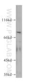 VPS33B Late Endosome And Lysosome Associated antibody, 12195-1-AP, Proteintech Group, Western Blot image 