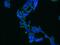 Adaptor Related Protein Complex 2 Subunit Alpha 1 antibody, 11401-1-AP, Proteintech Group, Immunofluorescence image 