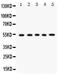 Vitronectin antibody, PB9458, Boster Biological Technology, Western Blot image 