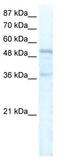 Forkhead Box C1 antibody, TA330238, Origene, Western Blot image 
