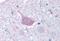 Mas-related G-protein coupled receptor member D antibody, NLS4128, Novus Biologicals, Immunohistochemistry frozen image 
