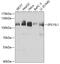 Epidermal Growth Factor Receptor Pathway Substrate 15 Like 1 antibody, GTX33184, GeneTex, Western Blot image 