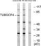 Tubulin Gamma Complex Associated Protein 4 antibody, TA315372, Origene, Western Blot image 